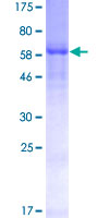 12.5% SDS-PAGE Stained with Coomassie Blue.